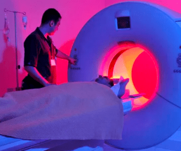 Website Background showing MRI for OIA